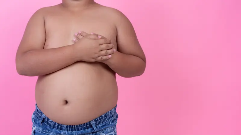 Obesitas pada Anak Bisa Picu Gangguan Kesehatan Mental, Begini Penjelasan Dokter