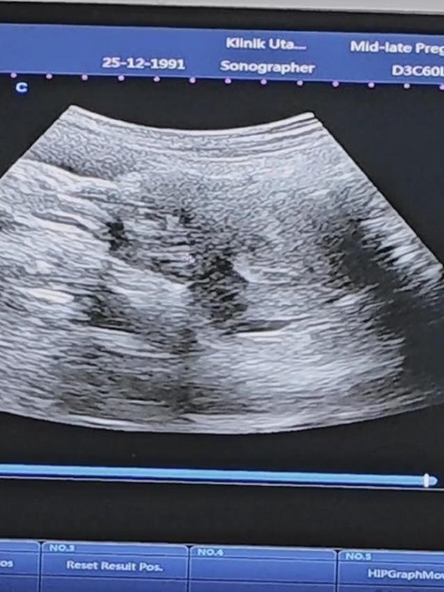 Potret calon anak ketiga Alyssa Soebandono dan Dude Harlino (Sumber: Instagram/ichasoebandono dan Instagram/dude2harlino)