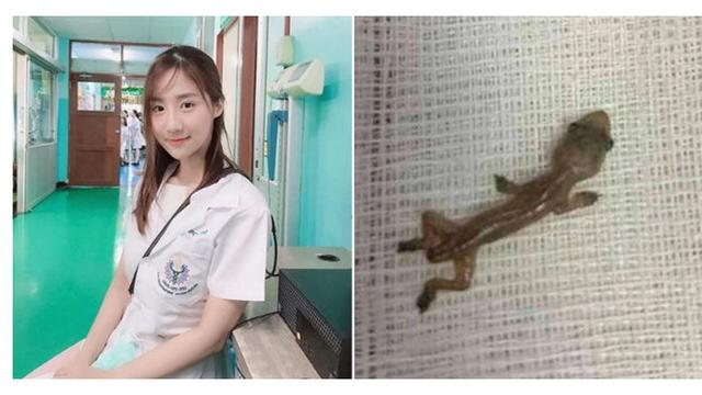 Dokter Ini Syok Temukan Hewan Hidup di Telinga Pasiennya