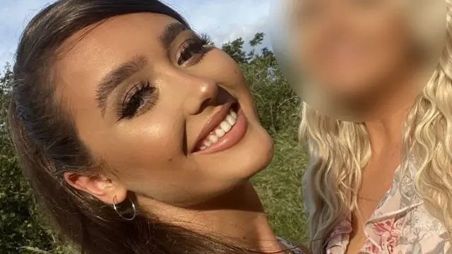 Lakukan Suntik Filler dengan Harga Murah, Bibir Wanita Ini Malah Bengkak Seperti Mau Meletus