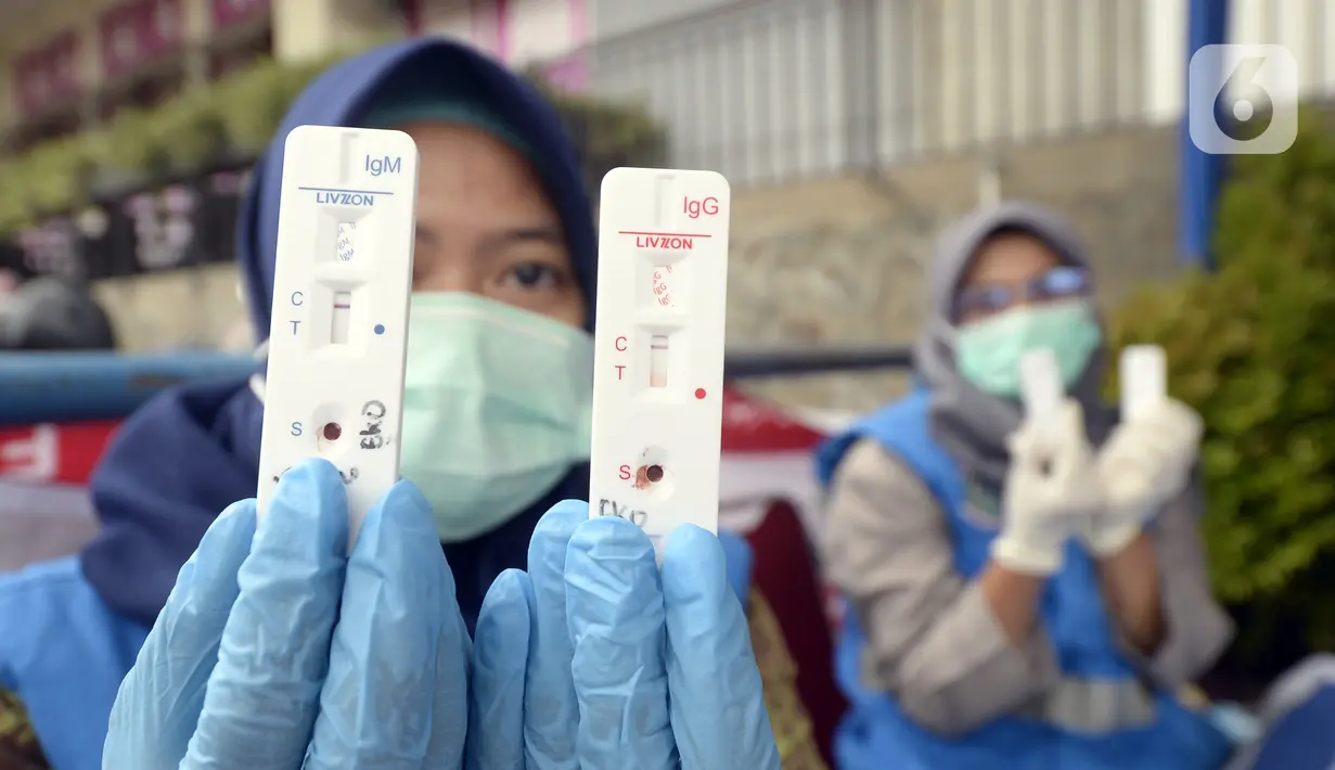 Petugas medis menunjukkan hasil rapid test warga di Pos PAM Pamulang Square, Tangerang Selatan, Banten, Jumat (25/12/2020). Rapid test gratis yang digelar Polres Tangerang Selatan tersebut bertujuan untuk mencegah penularan COVID-19 saat Natal dan Tahun Baru. (merdeka.com/Dwi Narwoko)