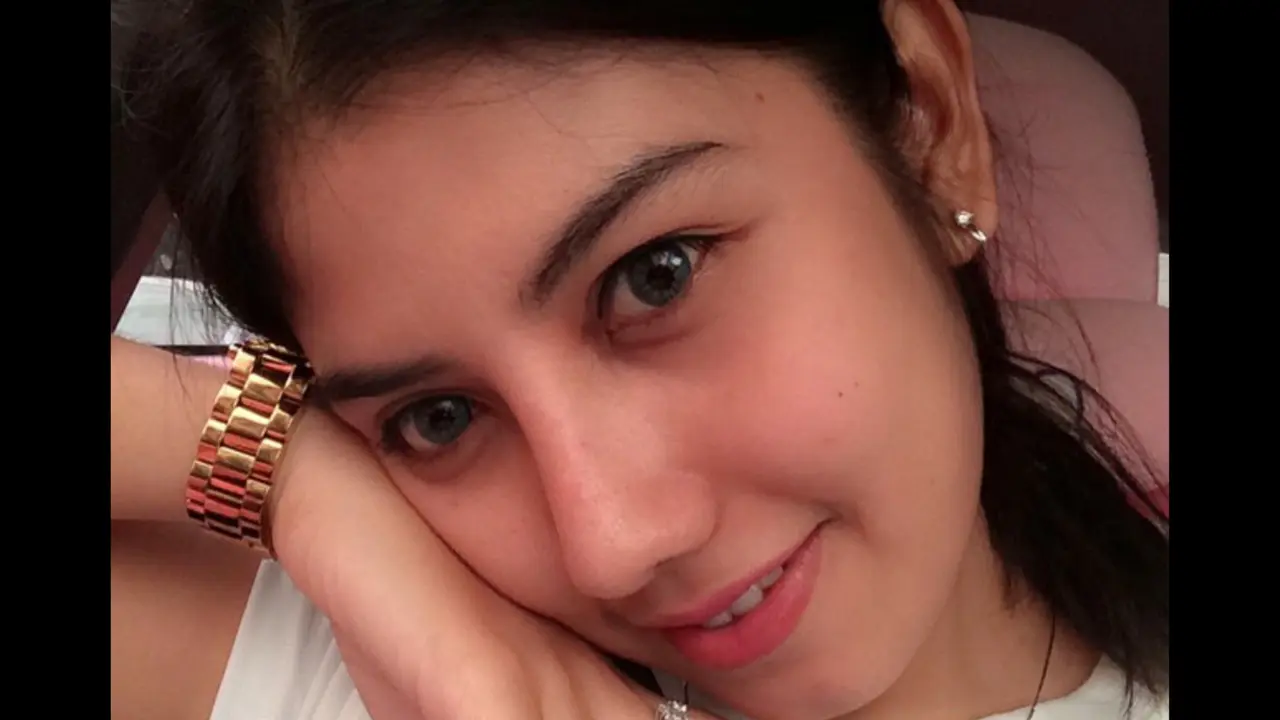 3 Perubahan Wajah Icha Calista, Adik Bella Shofie