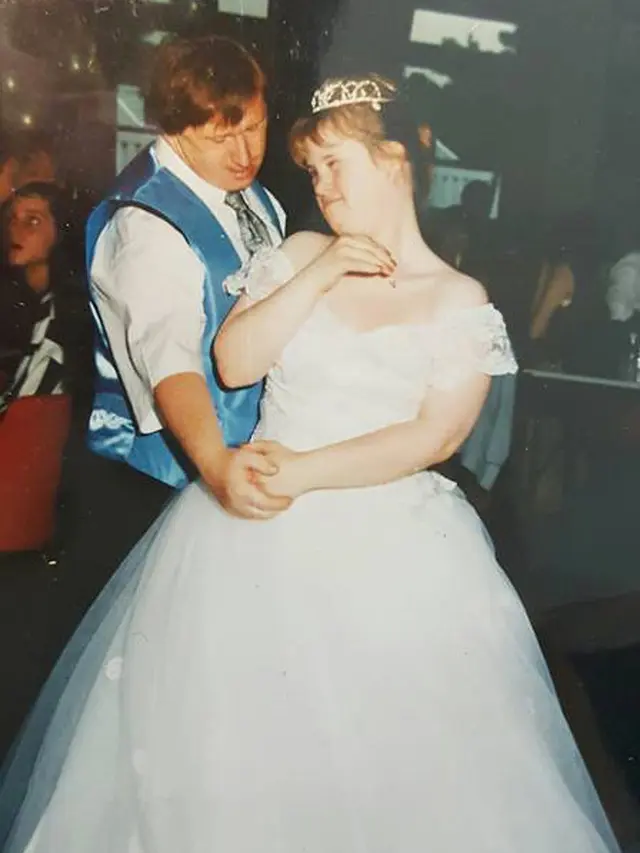 [Bintang] Down Syndrome