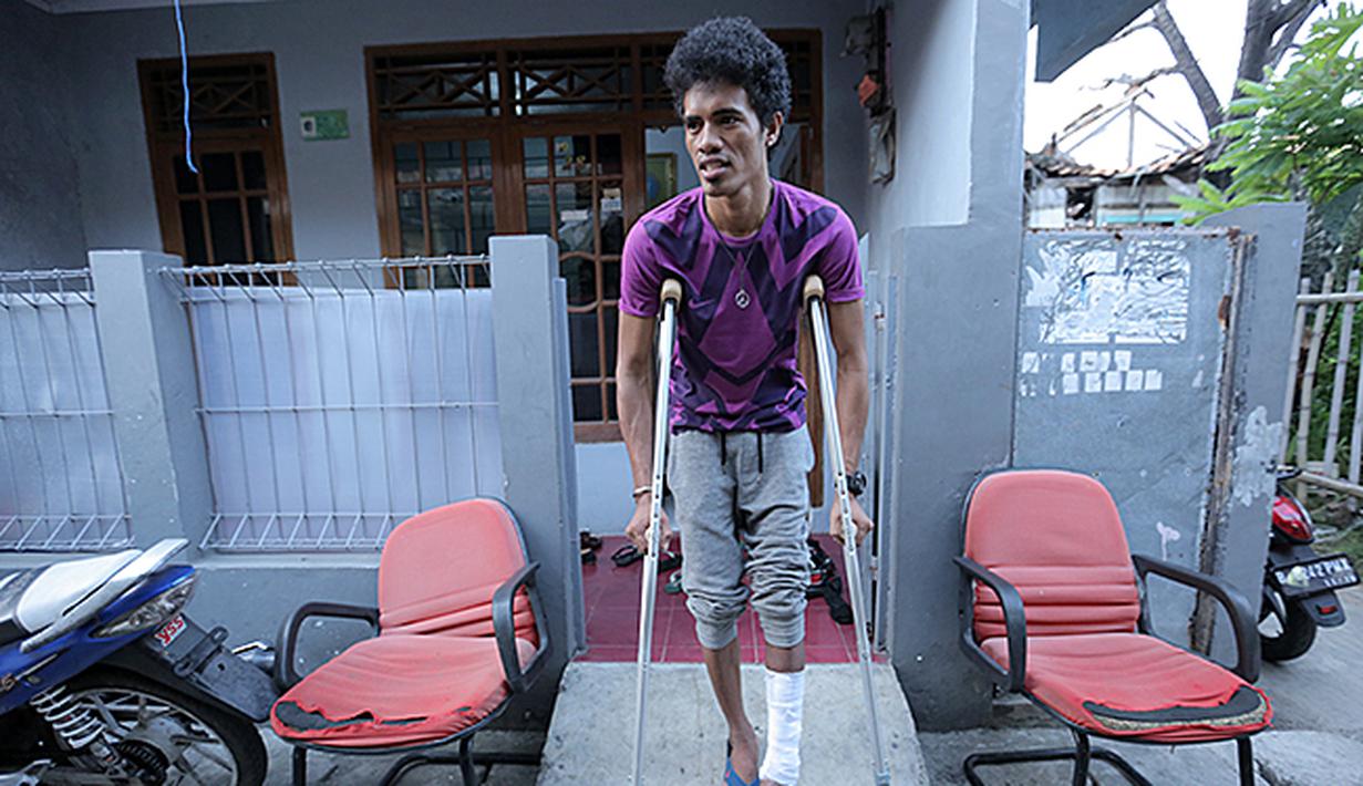 Alfi Tuasalamony rajin berlatih jalan untuk membantu proses penyembuhan cederanya. (Bola.com/Peksi Cahyo)