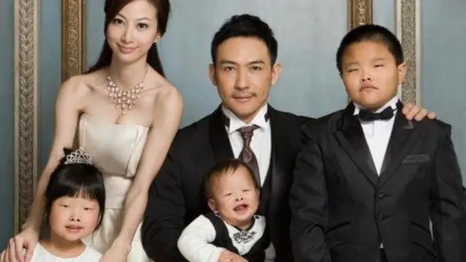 15 Foto Perubahan Wajah Orang Korea Setelah Operasi Plastik 