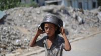 UNRWA menyebut bahwa salah satu kliniknya di Gaza mencatat peningkatan jumlah kasus malnutrisi sejak Maret 2025 lalu, ketika pengepungan total oleh Pemerintah Israel mulai diberlakukan. (Eyad BABA/AFP)