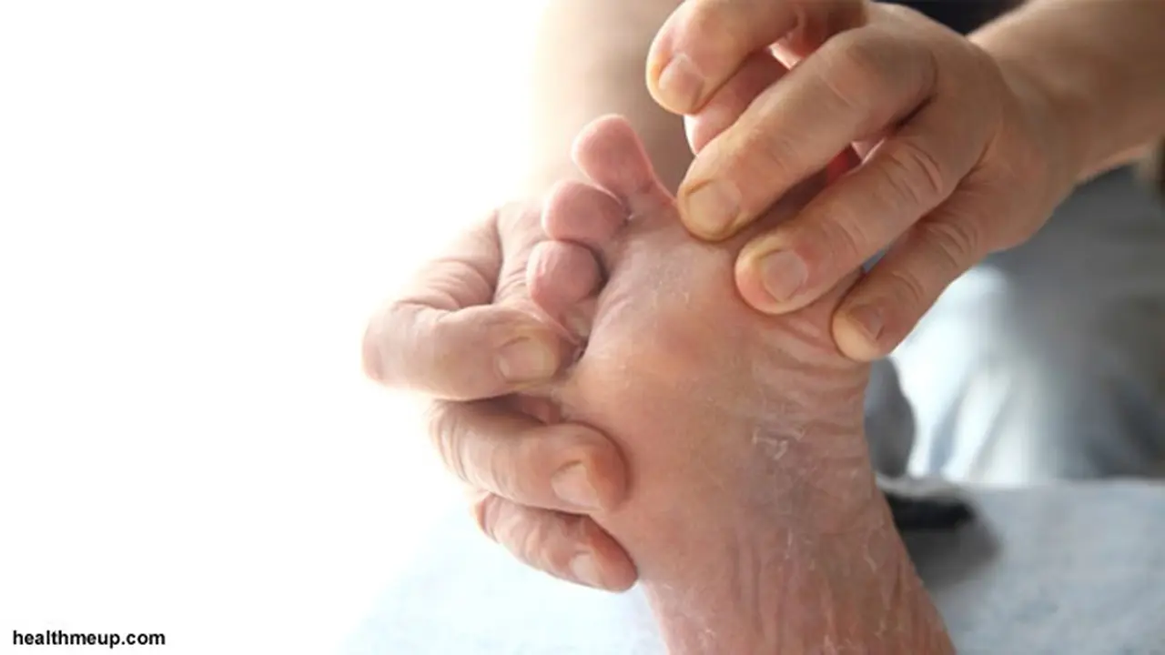 kaki-diabetik-131030b.jpg