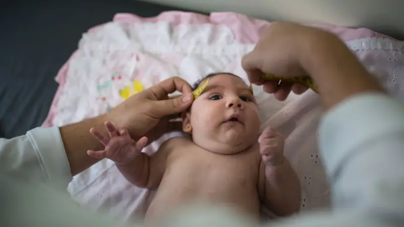 Bayi Cacat Lahir Kian Meningkat di Brasil