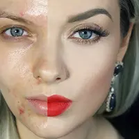 Nggak selamanya beauty vlogger alias pemberi tutorial kecantikan di Youtube punya wajah mulus. Sebagian dari mereka punya masalah jerawat.