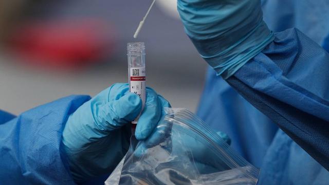 Beberapa lembaga kesehatan, termasuk CDC dan WHO, telah memantau gelombang baru Virus Corona COVID-19 Varian BA.2.86. (Arnulfo Franco/AP)