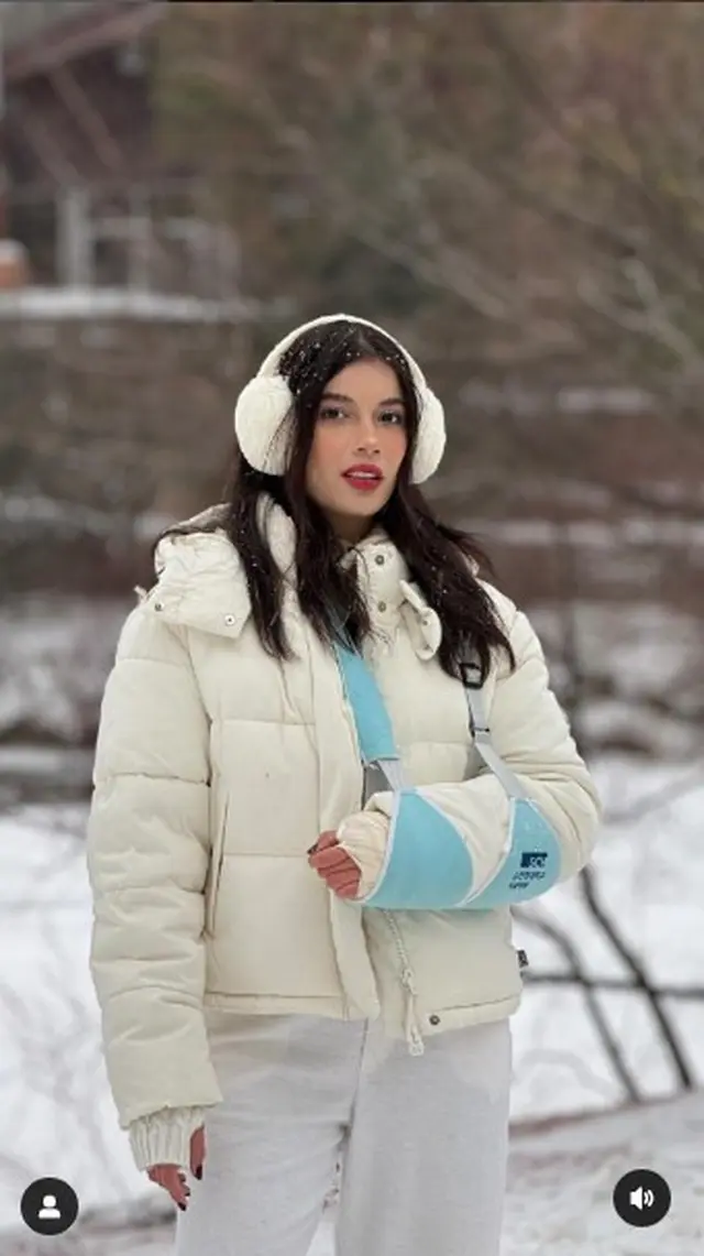 2. Dirinya pun tampak selalu memakai gips selama berada di Korea Selatan.