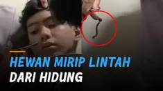 Momen berikut sukses buat warganet geli sekaligus ngilu.