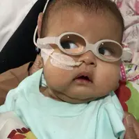 Anak kedua yang telah dinanti selama delapan tahun itu kini memakai kaca mata. Kacamata yang dipakai itu berbeda dengan kacamata dewasa, guna membantu retinanya berkembang baik setelah operasi. (Instagram/asri_welas)
