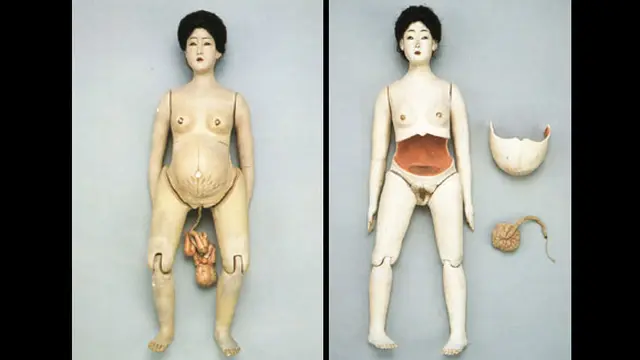 (c) zygoma.tumblr.com