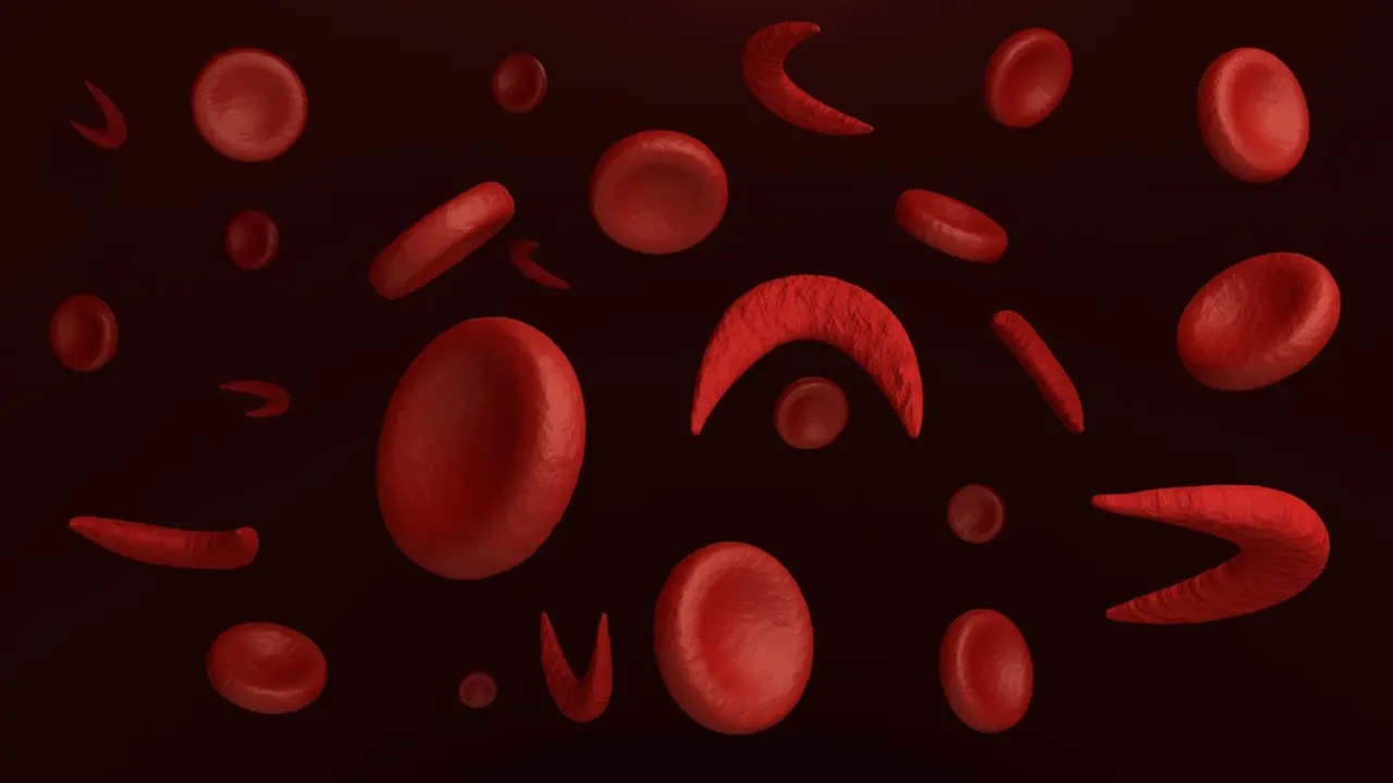 Mengenal Anemia Sel Sabit Lebih Dekat (extender_01/Shutterstock)