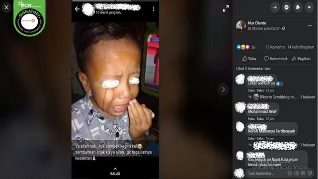Gambar Tangkapan Layar Bocah yang Diklaim Terkena Penyakit Mata karena Terlalu Lama Bermain Handphone (sumber: Facebook)