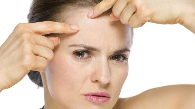 Langkah Cepat Menghilangkan Jerawat Dalam Semalam Beauty Fimela Com