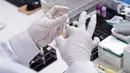Peneliti mengambil sampel di Laboratorium Pusat Prodia di Jakarta, Rabu (3/6/2020). Prodia Bone, Muscle and Joint Genomics mampu memprediksi  risiko 6 (enam) penyakit terkait tulang otot dan sendi. (Liputan6.com/HO/Deny)