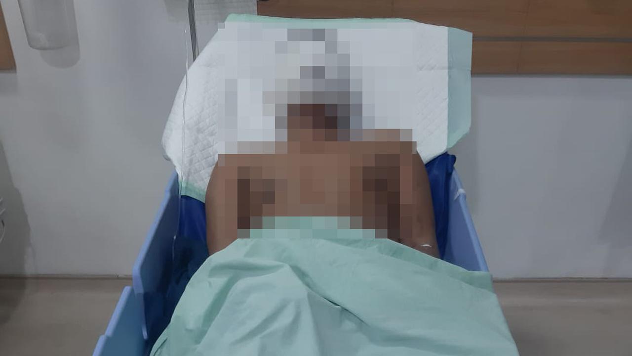 Wartawan Medan Disiram Air Keras