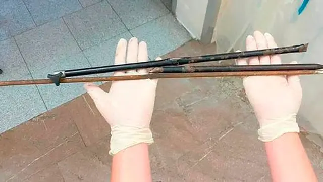 Hampir Terkena Alat Vitalnya, Kisah Bocah yang Tertusuk Alat Pancingan Ini Bikin Pilu