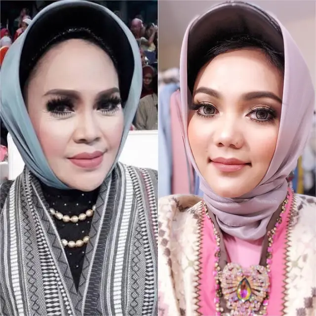 Rina Nose. (Foto: Instagram @rinanose16)