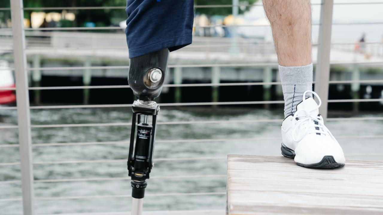 Ilustrasi Berujung pada Amputasi dan Disabilitas, Ini Alasan Luka pada Pasien Diabetes Melitus Jarang Disadari. Foto: Lara Jameson, Pexels.