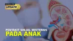 Ikatan Dokter Anak Indonesia (IDAI) menyebut terjadi lonjakan kasus gangguan ginjal akut misterius dalam dua bulan terakhir. Akumulasi kasus dari Januari hingga akhir September di Indonesia ada lebih dari 100 anak di Indonesia yang mengalami kondisi ...