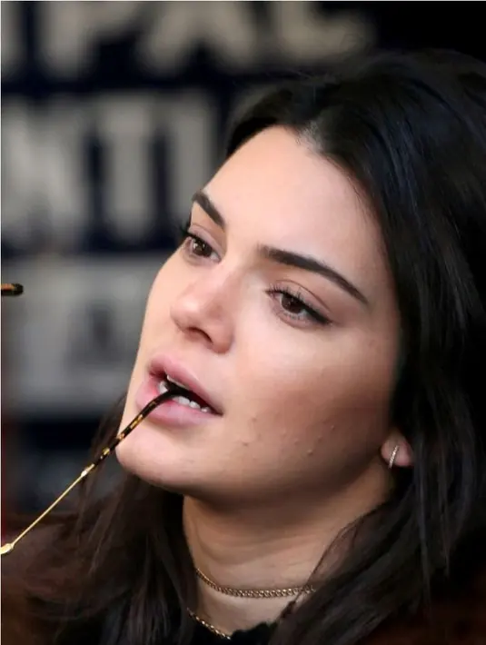 "Siapa bilang model nggak boleh jerawatan? Itu semua bohong! (Kendal) kamu sempurna apa adanya. Aku mencintaimu!" tulis akun @signofkendall. (Pinterest)