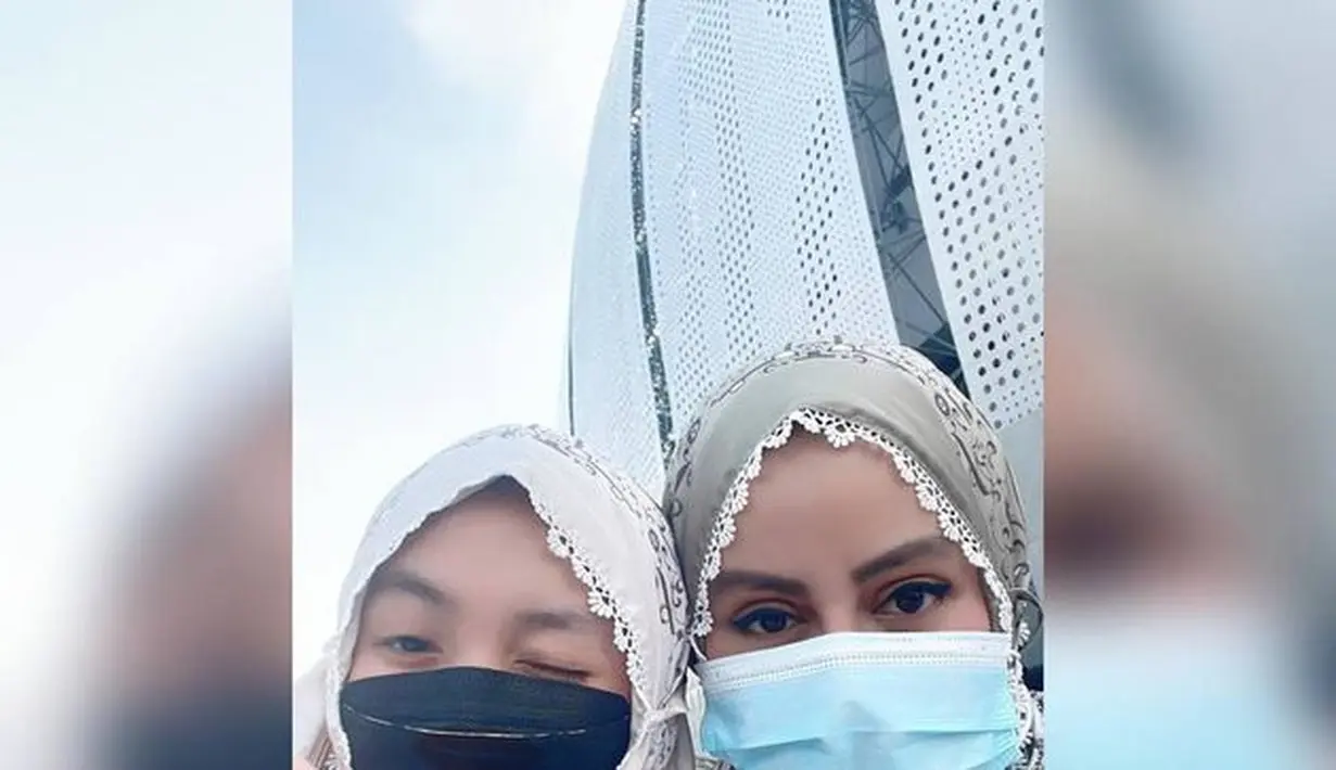 Nita Thalia berjuang untuk kesembuhan kerusakan saraf (Instagram/nitatalia.real)