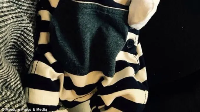 Bayi Alfie yang memiliki raut wajah pemarah. (Sumber Foto: Dailymail)