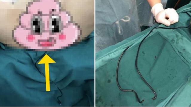 Gara-Gara Gatal, Kabel Charger Malah Tersangkut di Penis