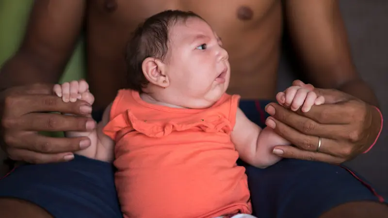 Virus Zika Menyebar, Ribuan Bayi Brazil Lahir dengan Kepala Kecil