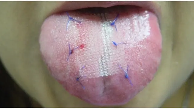 Foto: copyright chacha.com