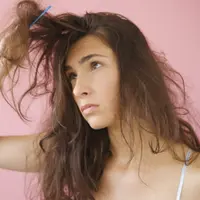 Rambut kering dan tipis: Kurang asupan nutrisi. (Via: youne.com)