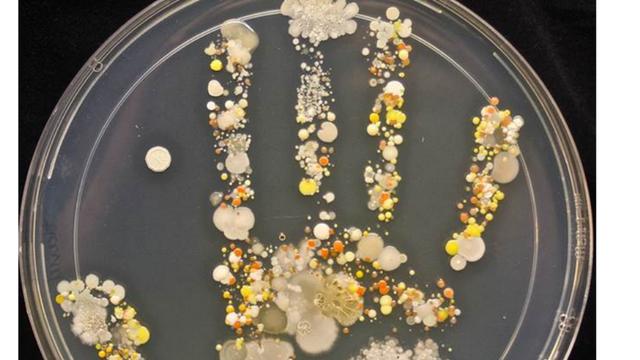 Ini Penampakan Bakteri Di Tangan Anak Usai Bermain Health