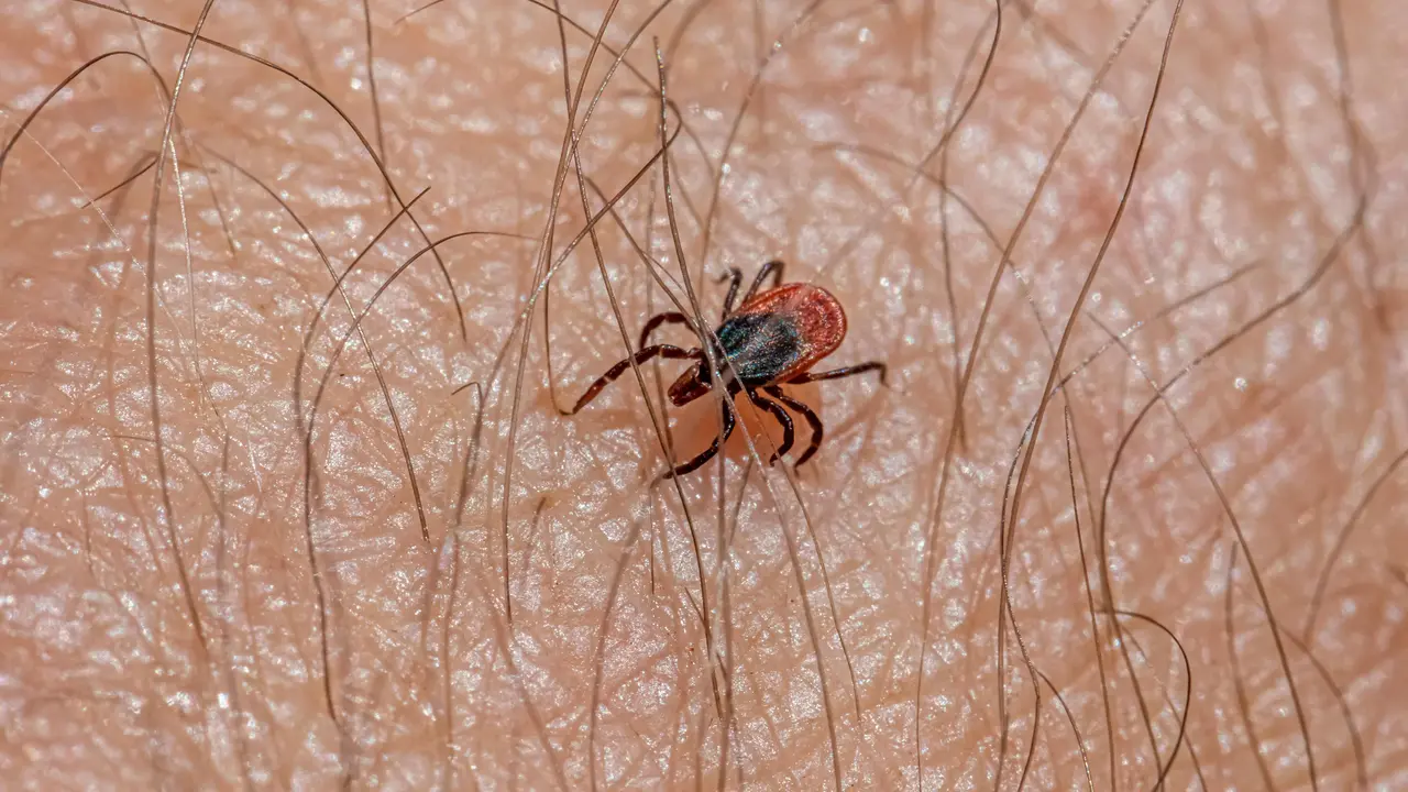Dari Gigitan Kutu Bisa Sebabkan Penyakit Lyme, Apa Saja Tanda-Tandanya? [Dok/pexels.com]