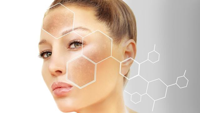 Ilustrasi hiperpigmentasi