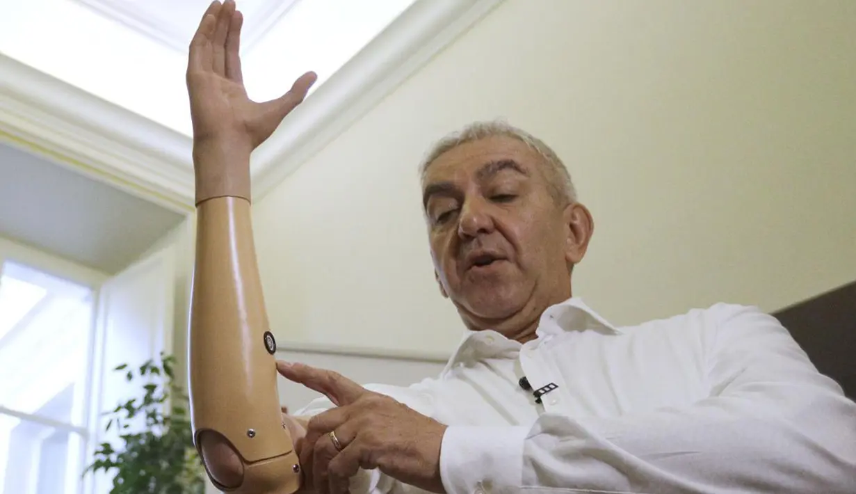 Marco Zambelli menunjukkan tangan prostetiknya di Roma, 10 Mei 2018. Lengan buatan ini hanya memiliki satu motor yang mengendalikan keseluruhan lima jari, membuatnya lebih ringan dan lebih mampu beradaptasi pada bentuk berbagai benda. (AP/Gregorio Borgia)