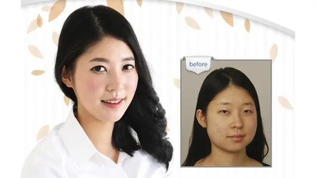 (c) kpsurgery tumblr.com