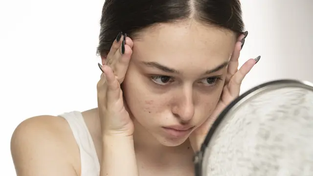 Muncul Kerutan Mata di Usia Muda yang Mengganggu Penampilan, Begini Cara Mengatasinya dengan Tepat