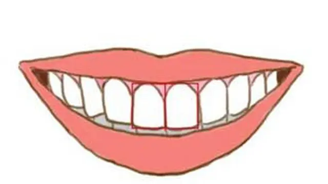 kepribadian berdasarkan bentuk gigi