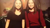 Berkat Youtube,  gadis kembar ini kembali bertemu setelah berpisah selama 25 tahun