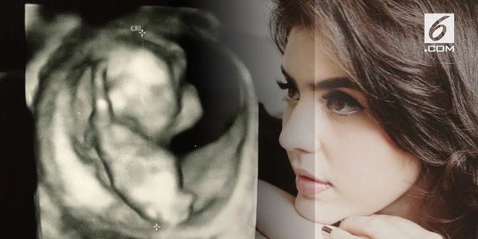 VIDEO: Selamat, Carissa Puteri Hamil Anak Kedua