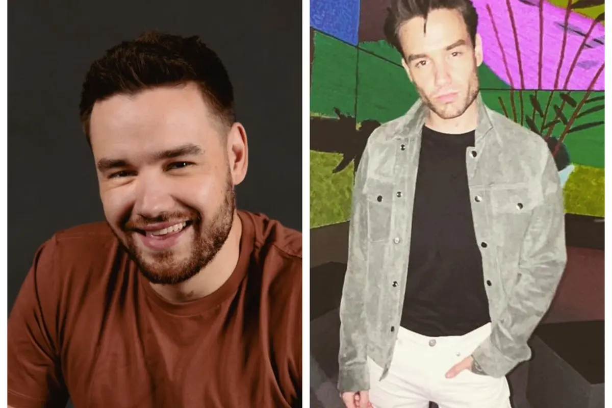 Wajah Liam Payne Jadi Lebih Kotak, Begini Prosedur Kecantikan yang Dijalani Menurut Dokter Kulit