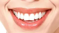 Gigi putih memang menjadi dambaan setiap orang, terlebih gigi putih bisa dimiliki dengan bahan alami yang mudah didapat.
