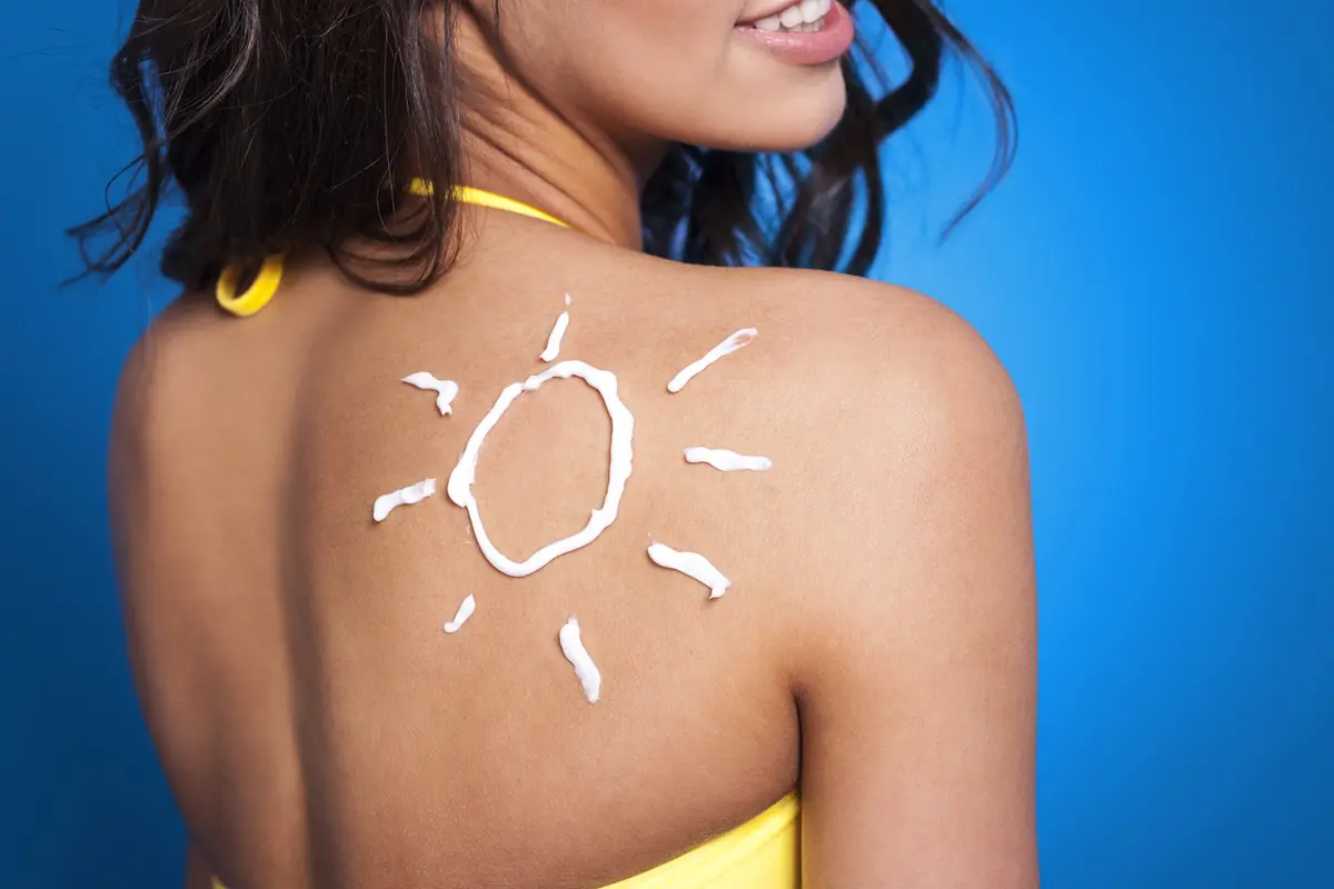 sun burn