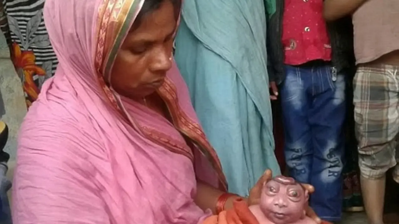 Terlahir dengan Wujud Aneh, Bayi Diklaim Sebagai Dewa