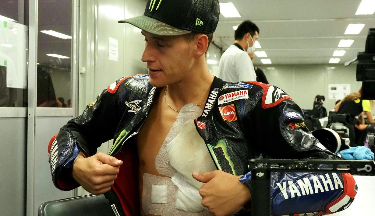 Pembalap Yamaha, Fabio Quartararo memamerkan tubuhnya yang penuh dengan tempelan perban akibat insiden Quartararo yang menabrak motor Marc Marquez pada awal-awal balapan MotoGP Aragon, pekan lalu. (AFP/Toshifumi Kitamura)
