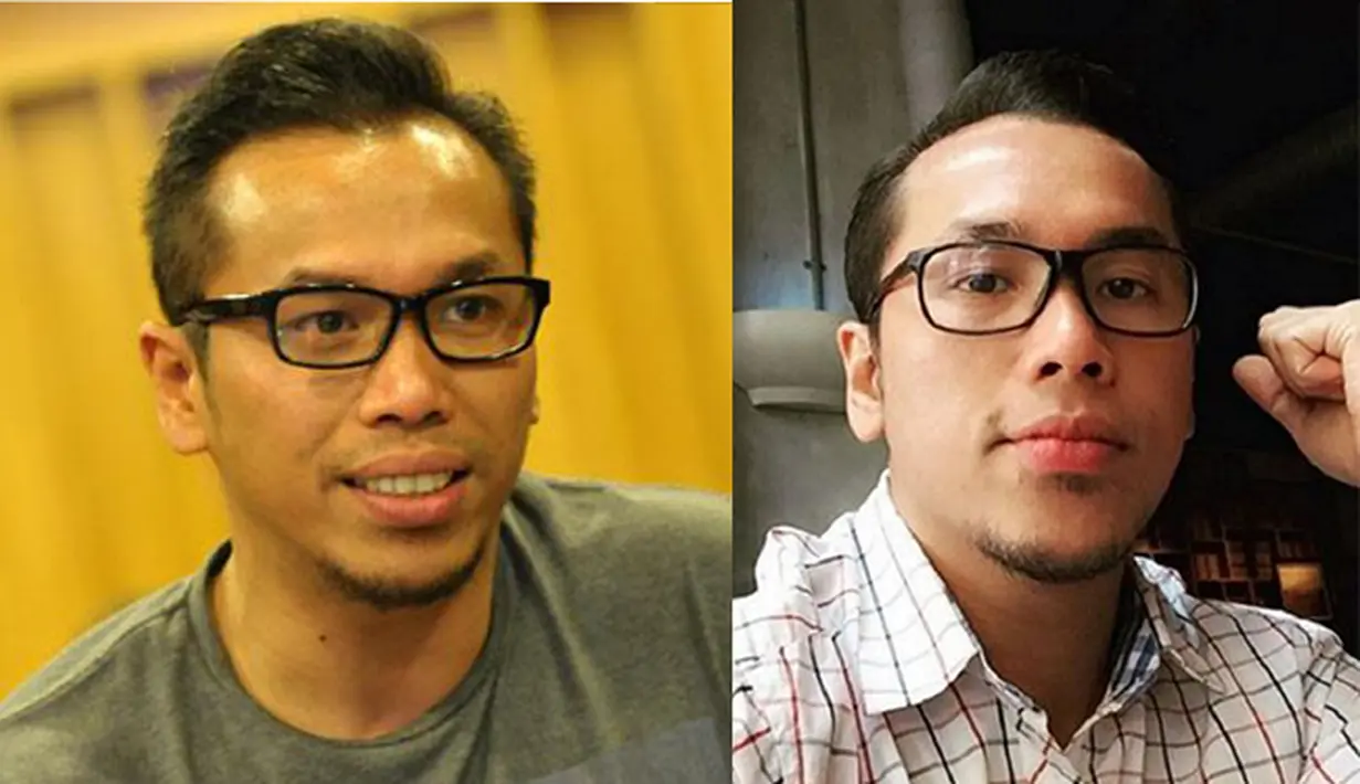 Perubahan wajah beberapa penyanyi wanita yang semakin cantik usai melakukan operasi plastik tentu sudah tak terlalu aneh lagi. Namun apa yang terjadi kalau pria yang melakukannya?. (Via Instagram/Sammy Simorangkir)