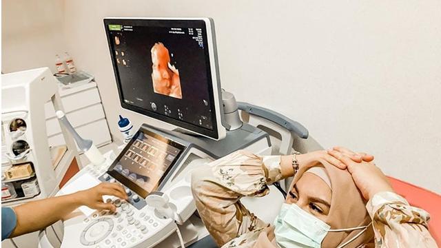 6 Potret Irish Bella Jelang Melahirkan, Dipercepat Karena Luka Operasi Sesar